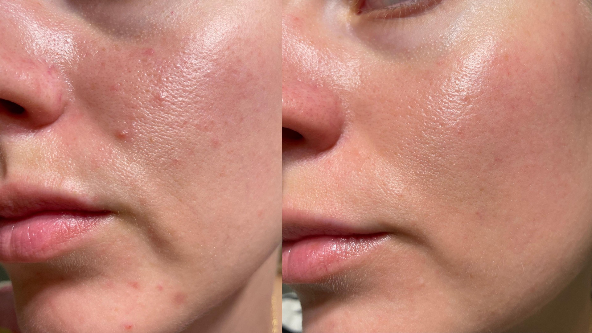 Ilustrační obrázek účinku aplikace přípravku Rejuran